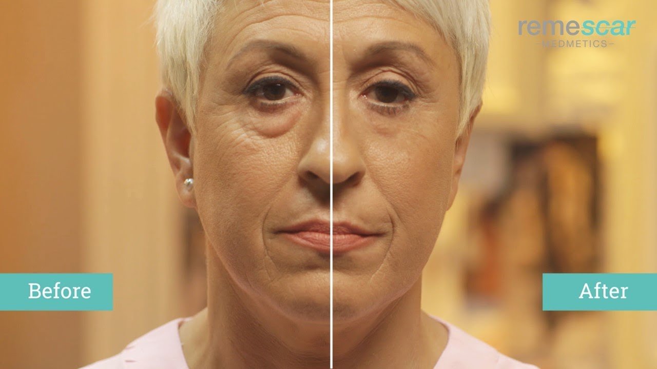 REMESCAR POCHES & CERNES 8ML